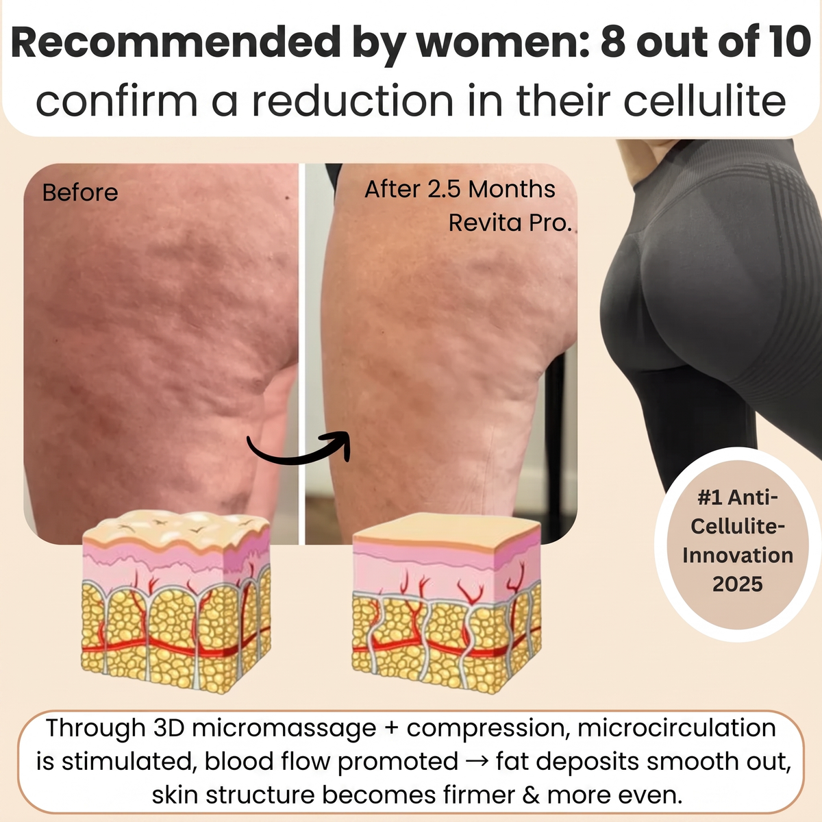 FEMILLIE PRO – Compression Leggings with a Calorie-Burning Effect and Skin-Firming Benefits