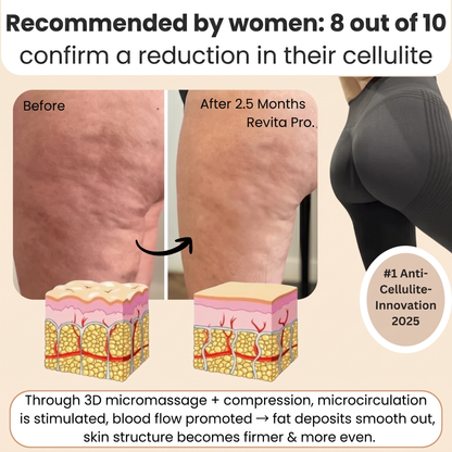 FEMILLIE PRO – Compression Leggings with a Calorie-Burning Effect and Skin-Firming Benefits