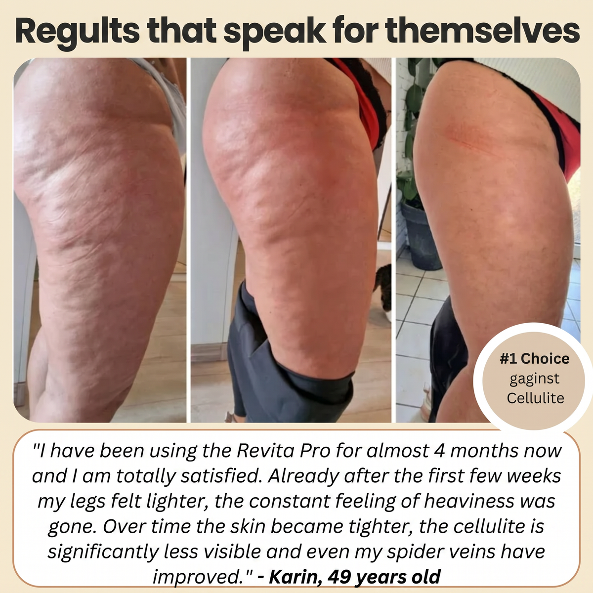 FEMILLIE PRO – Compression Leggings with a Calorie-Burning Effect and Skin-Firming Benefits