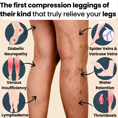 FEMILLIE PRO – Compression Leggings with a Calorie-Burning Effect and Skin-Firming Benefits